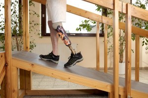 Innovations in Prosthetic Devices Improve Daily Activities